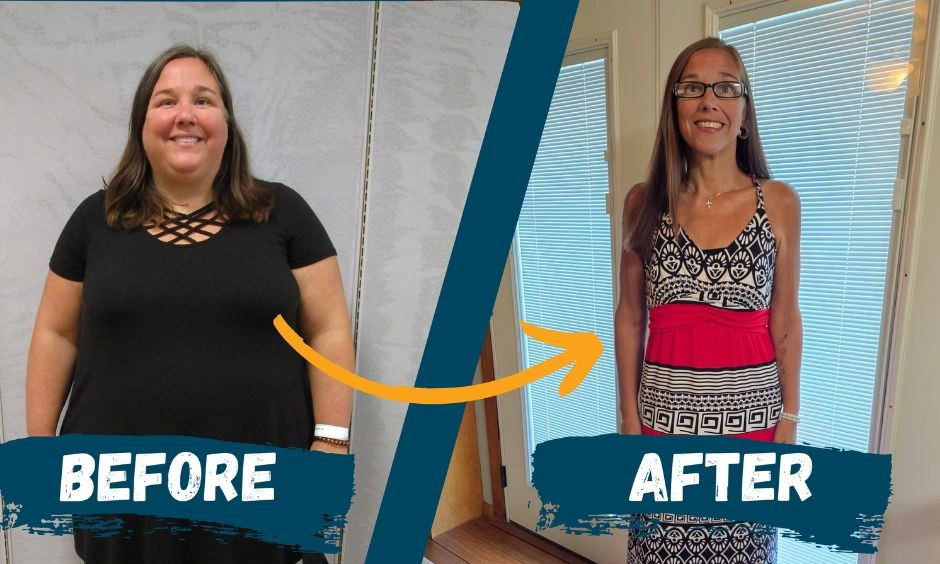 Natalie Childers before and after weight loss surgery