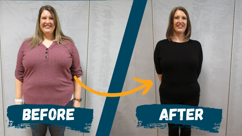 Amanda Keefer before and after weight loss surgery
