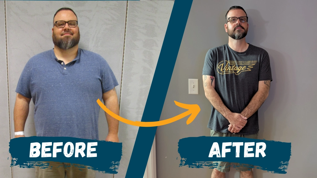 Richard Kimball before and after weight loss surgery